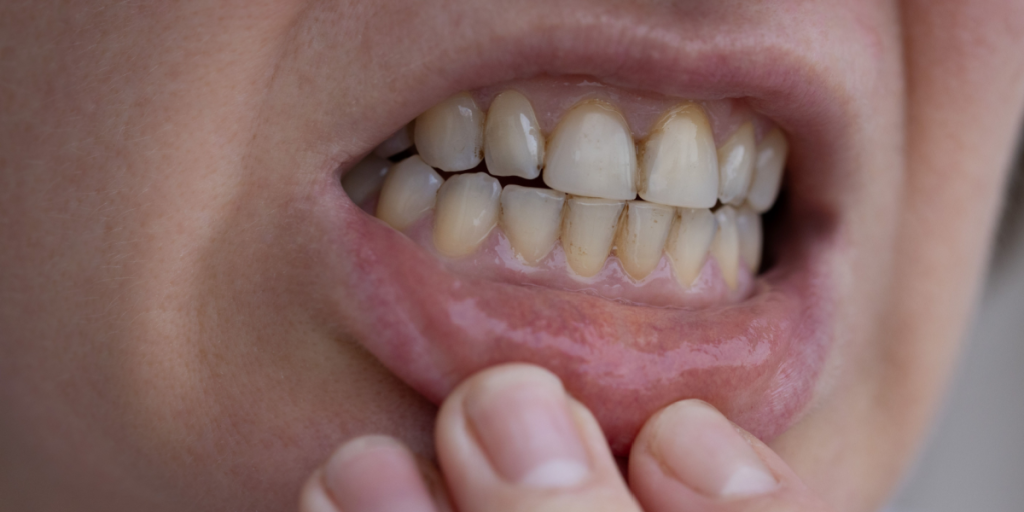 Dentists say everyday habits could be fading your smile